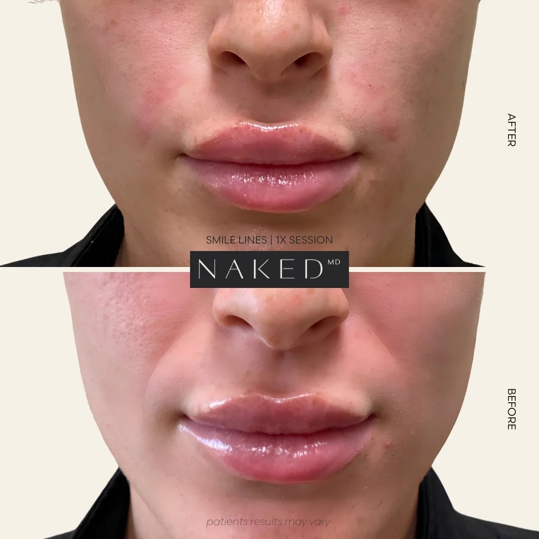 CollaGel - Image 7