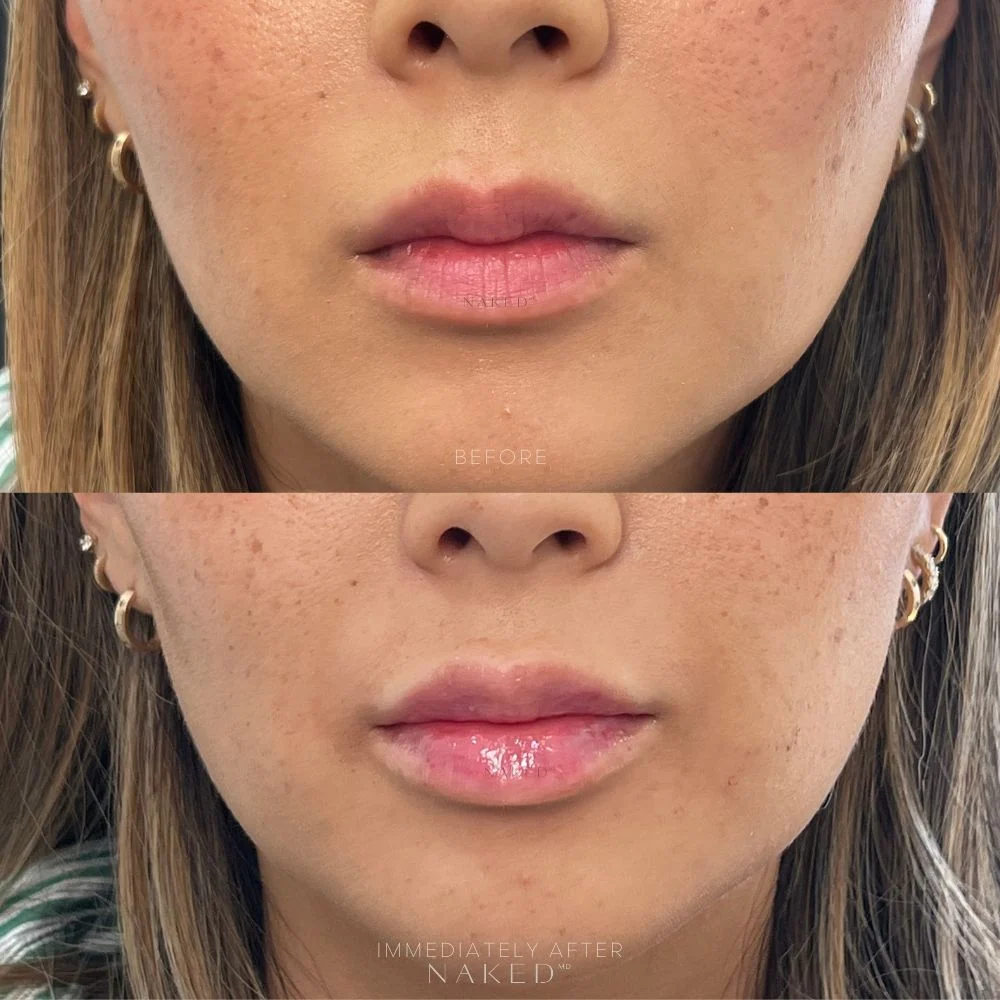 Naked Lips | Lip Filler - NV - Image 19