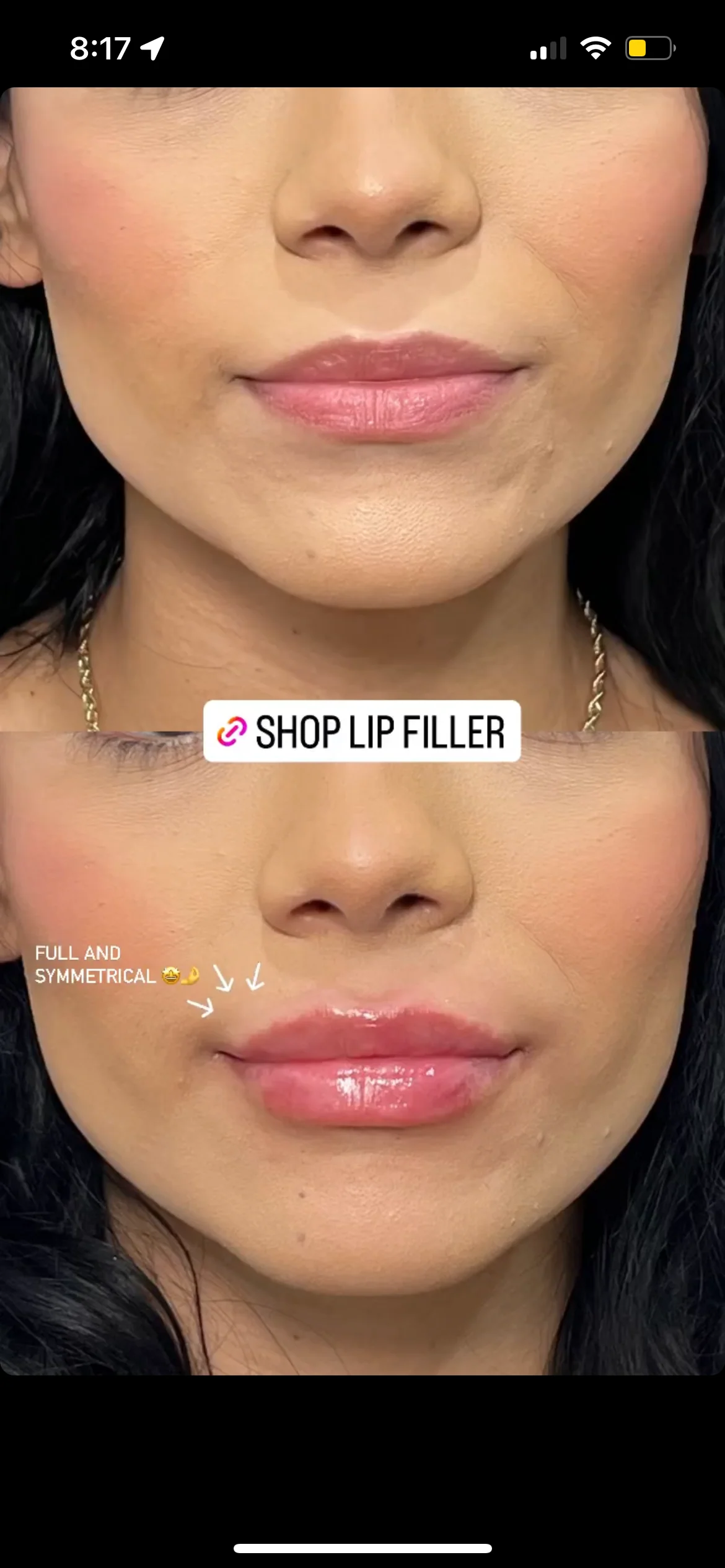 Naked Lips | Lip Filler - NV - Image 42