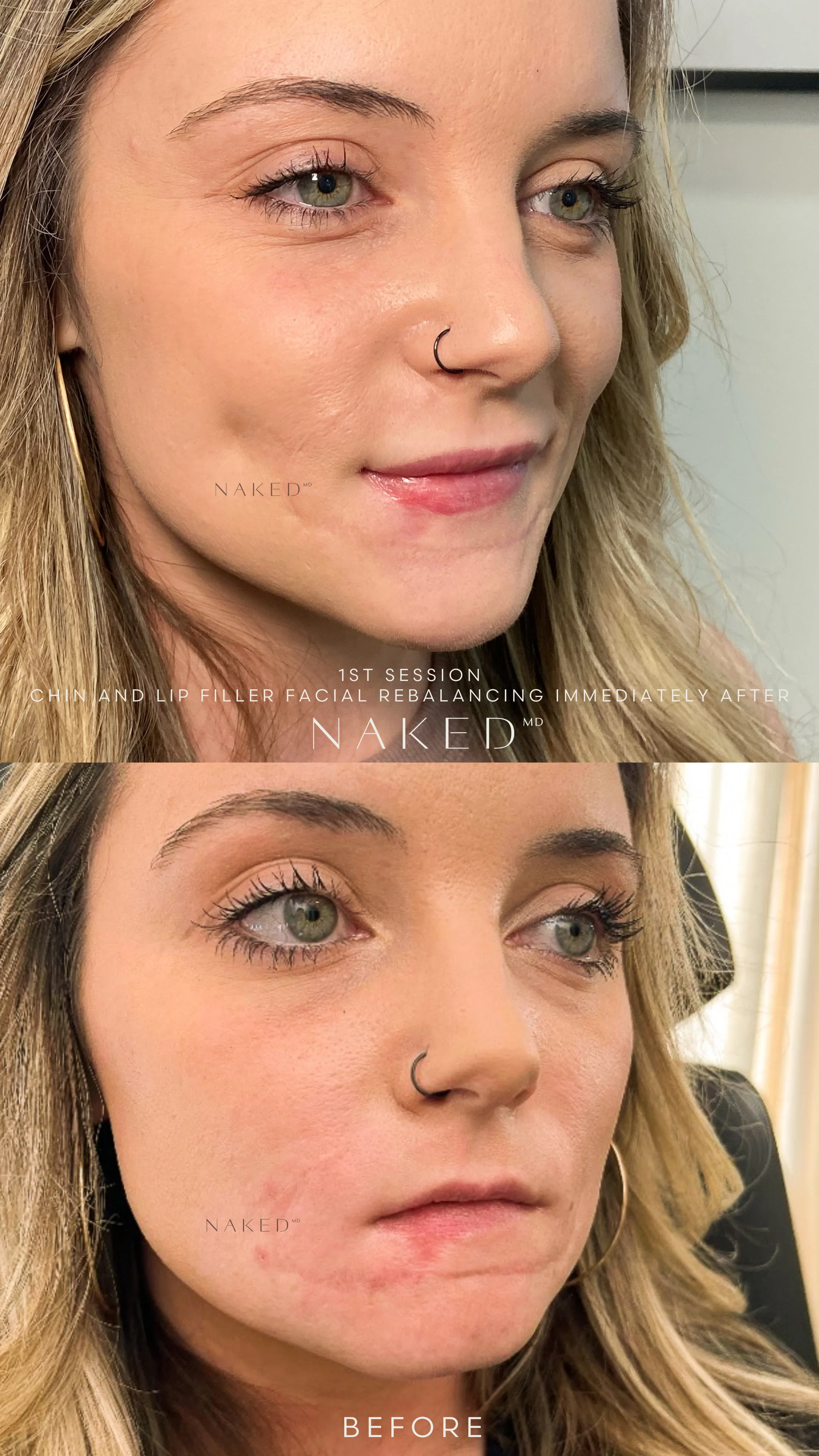 Naked Lips | Lip Filler - NV - Image 52