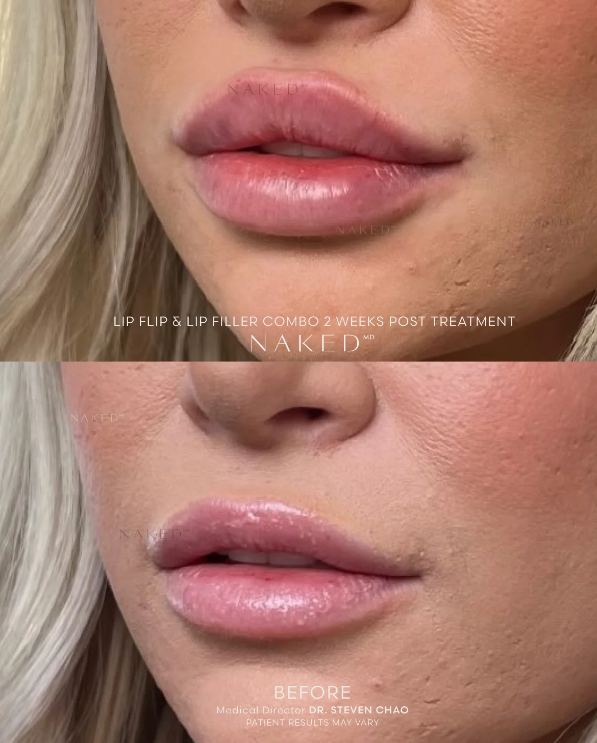 Naked Lips | Lip Filler - NV - Image 69